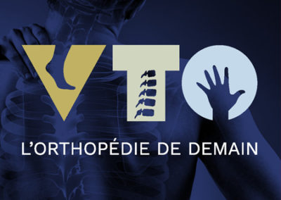 VTO